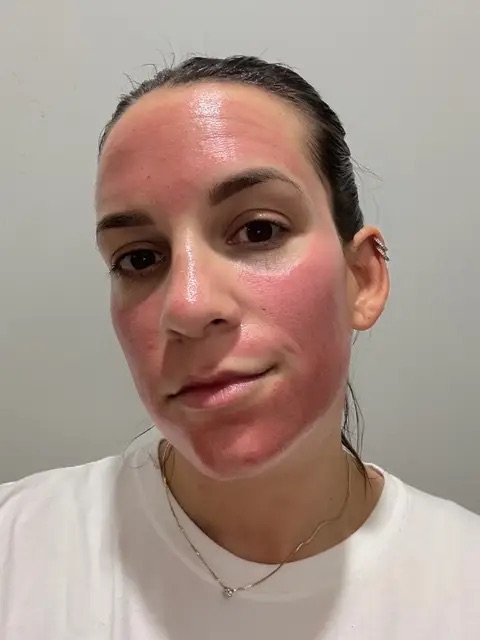 TikTok Post Thumbnail