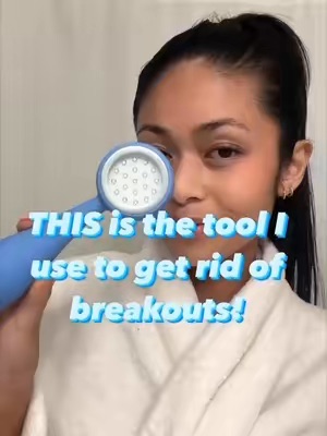 TikTok Post Thumbnail