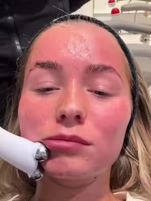 TikTok Post Thumbnail