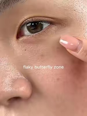 Post by saturdayskin