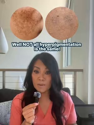 Post by slmdskincare