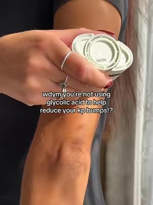 Post by theinkeylist