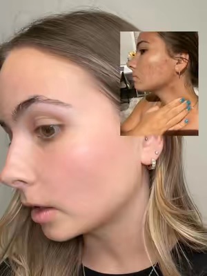 TikTok Post Thumbnail