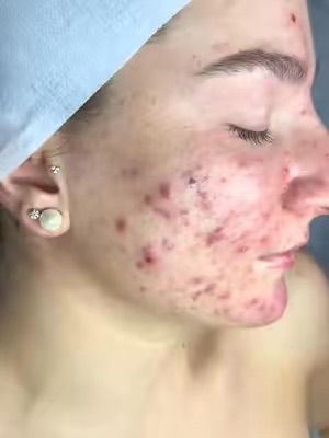 TikTok Post Thumbnail