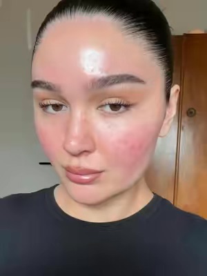 TikTok Post Thumbnail