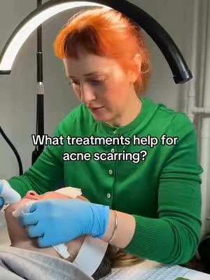 Post by sofiepavittface