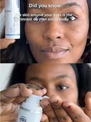 Post by eltamdskincare