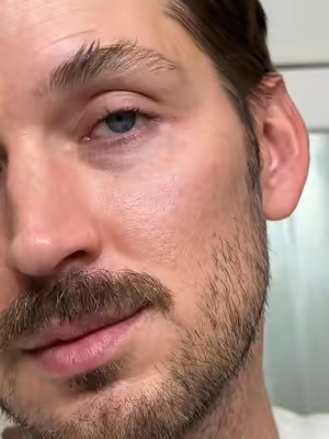 TikTok Post Thumbnail