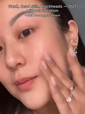 TikTok Post Thumbnail