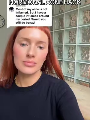 Post by sofiepavittface