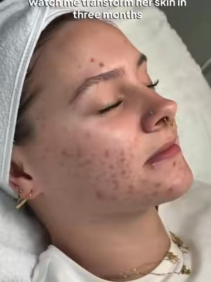 Post by facerealityskincare