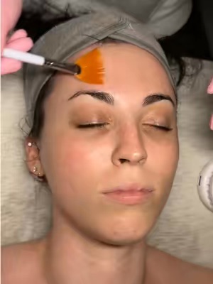 Post by officialpcaskin