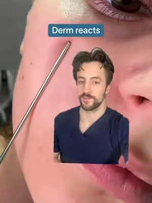 Post by dermarkologist