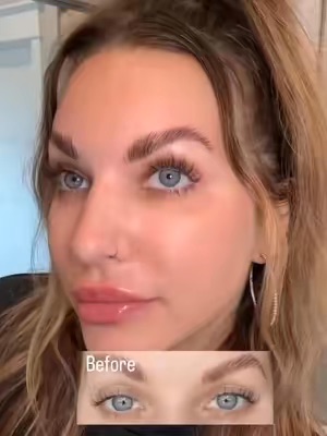 TikTok Post Thumbnail