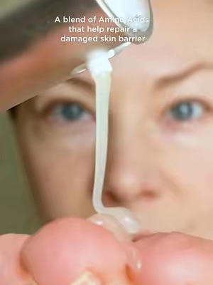 Post by eltamdskincare