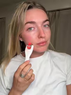 TikTok Post Thumbnail