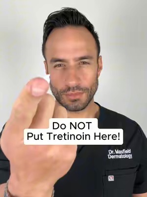 TikTok Post Thumbnail