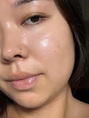 Post by muradskincare