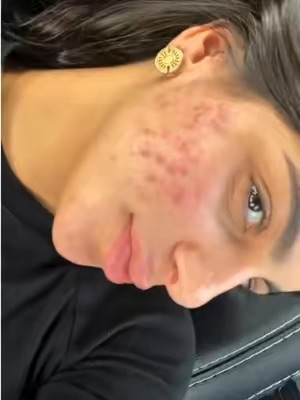 TikTok Post Thumbnail