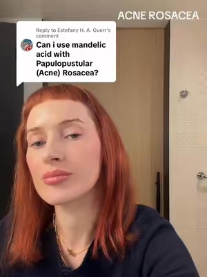 Post by sofiepavittface