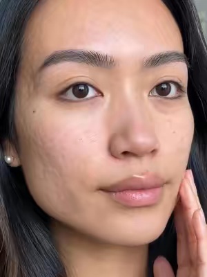 TikTok Post Thumbnail