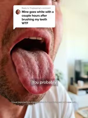 Related Post Thumbnail