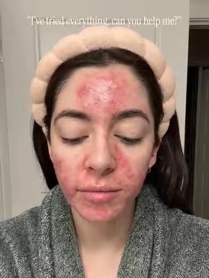 TikTok Post Thumbnail