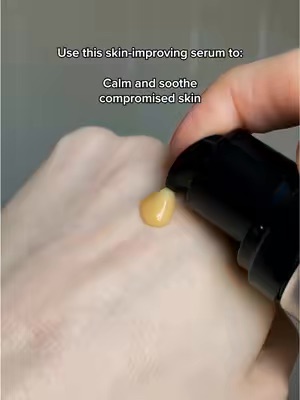 Post by officialpcaskin